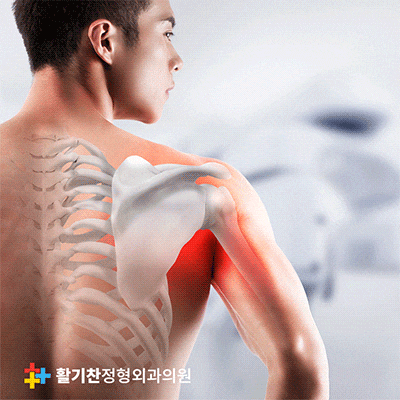  연신내 정형외과, 어깨통증 대표 회전근개파열