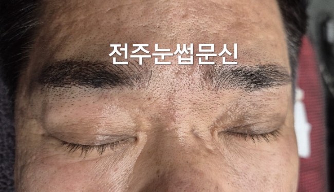  전주남자눈썹에 진심인 붉은잔흔커버 추천