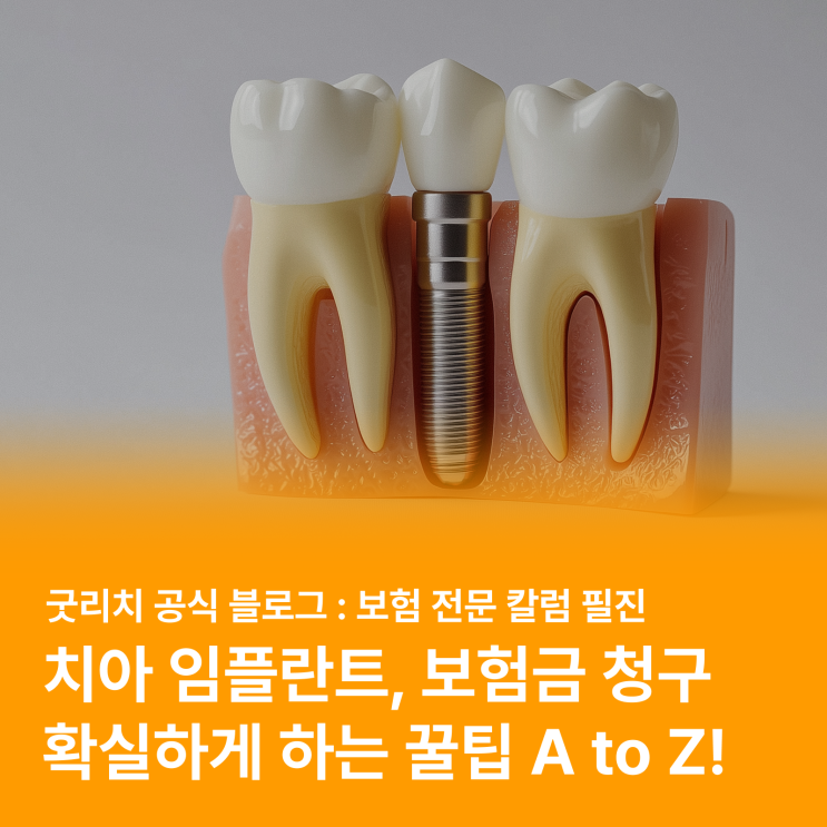  치과 치료, 임플란트 수술비 보험 청구? 이렇게만 하세요! (실비, 치과보험, 종수술비특약)