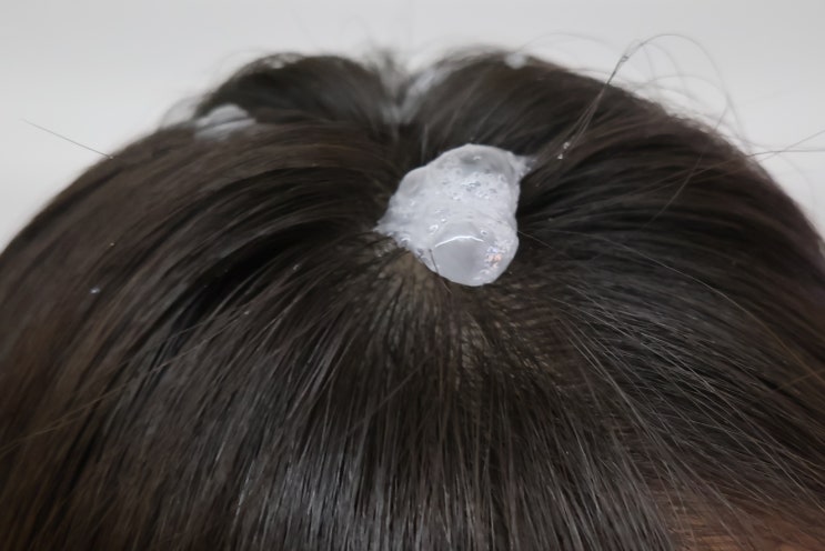  두피 열감 해소? 닥터스시크릿 쿨링 톡톡 버블토닉 솔직 후기! 탈모 증상 완화 효과까지