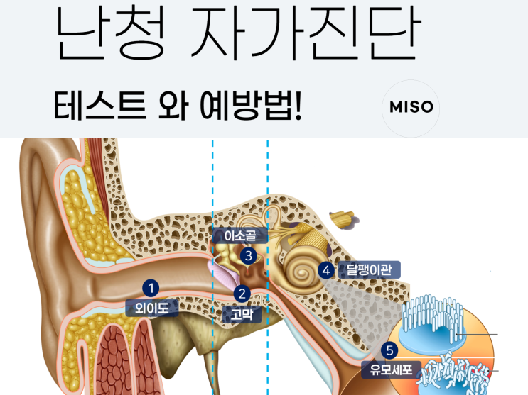  난청 자가진단 테스트와 예방법 총정리