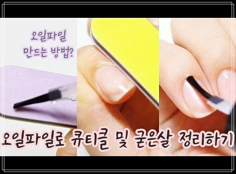  손톱살 제거 및 관리 방법
