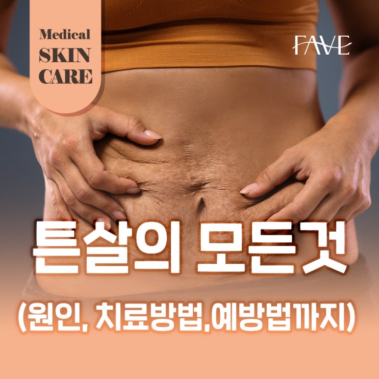  이촌역 피부과 튼살 없애는법 이렇게 관리하세요!