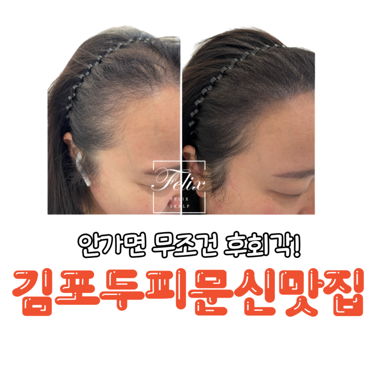  구래동남성두피문신가격
