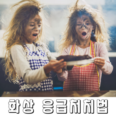 집에서 할 수 있는 화상 응급 대처법
