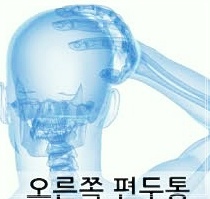  오른쪽 머리 찌릿 만성 두통 편두통 스트레스가 원인