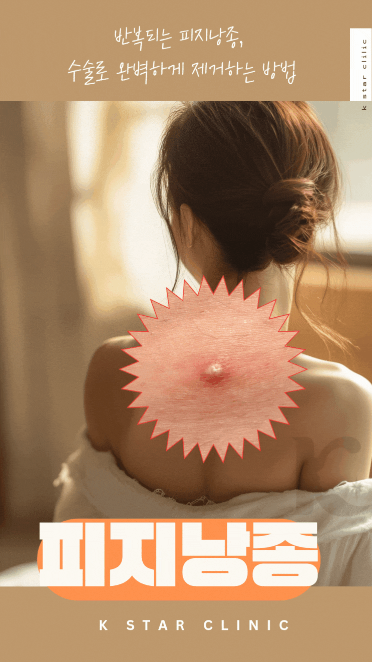  광주 피지낭종 커서 신경쓰였다면 수술로 제거하는 방법을