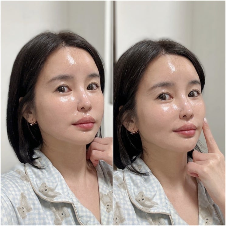 부산 서면역피부과 신부관리 딱인 레티젠 효과 내돈내산 후기 부산 서면역피부과 신부관리 딱인 레티젠 효과 내돈내산 후기