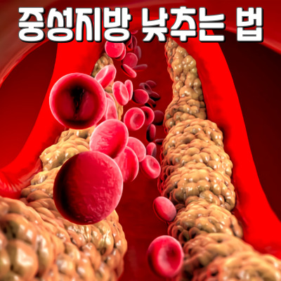 중성지방 낮추는 법: 원인, 이유, 치료 방법 총정리