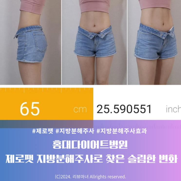  [ 홍대다이어트병원 ] 제로팻 지방분해주사로 찾은 슬림한 변화_최종 후기
