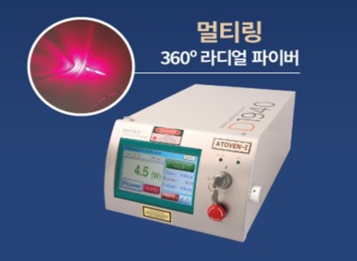  하지정맥정맥류 수술 방법 레이저 정맥 폐쇄술 EVLA