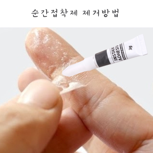 손에 묻은 순간접착제 제거방법 강력본드 지우는법