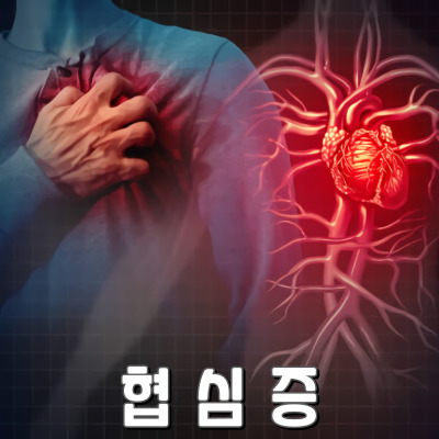 협심증 초기 증상과 대처법 : 심장을 지키는 첫걸음