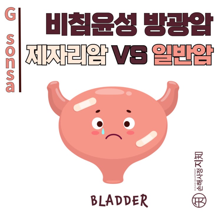  "비침윤성 방광암도 '암'이다, 제자리암 vs 악성신생물 판례 분석" - [판례, BoDa]