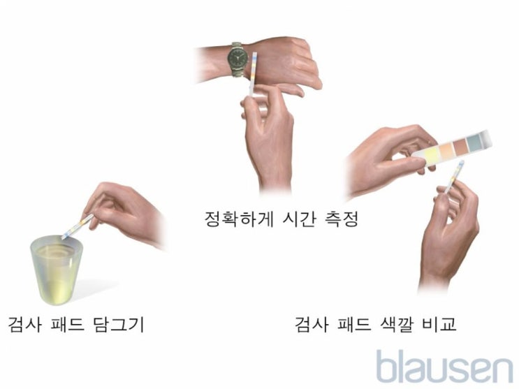 신장 및 요로 장애 평가