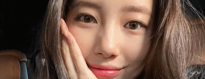 <b>수지 눈동자 점 제거</b> 결막모반 수술 후 이뻐진 얼굴