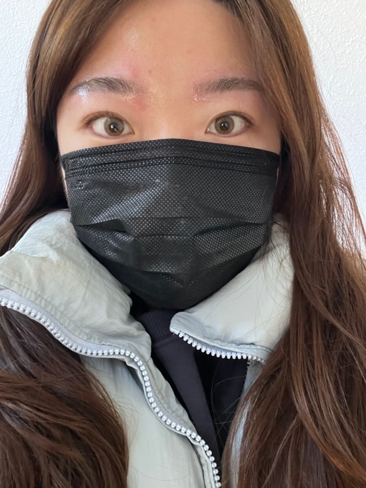  부산 전포 , 서면 붉은 눈썹 잔흔제거 1회차 후기 온하루뷰티