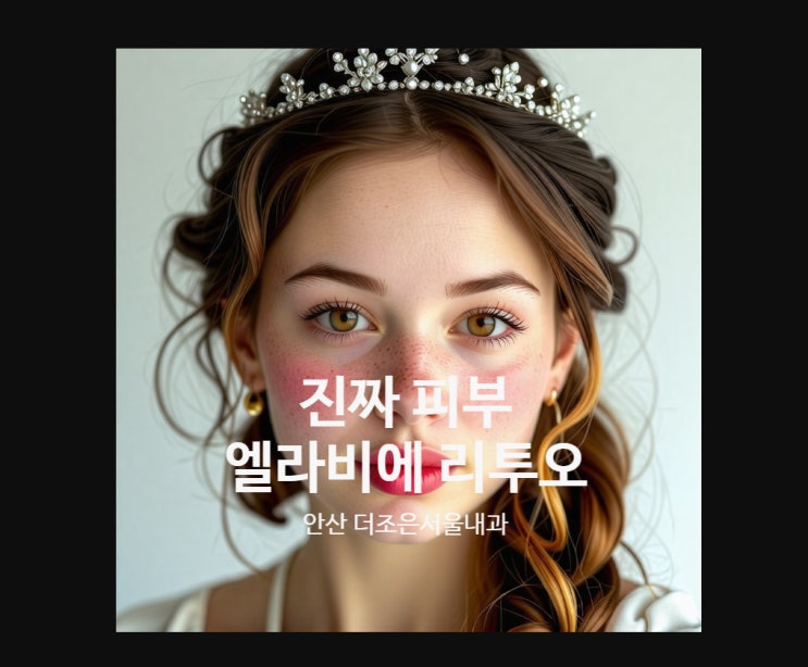  엘라비에 리투오와 레티젠 효과 비교 안산피부과