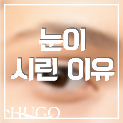 눈이시린이유와 대처 방법은 무엇일까