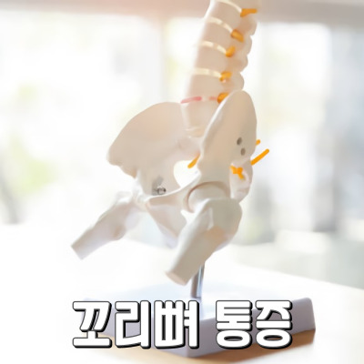 앉았다 일어나면 꼬리뼈가 아파요.