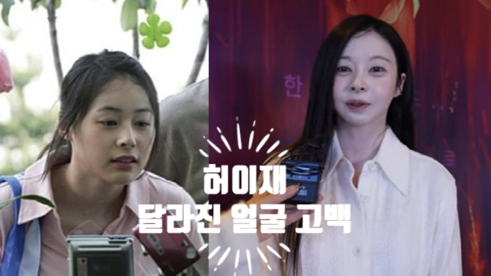  허이재 달라진 얼굴 상대 남자배우 트라우마 합병증 고백