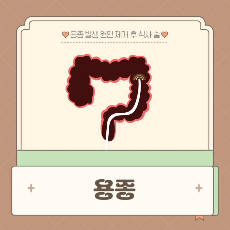 용종 생기는 이유 제거후 식사 술
