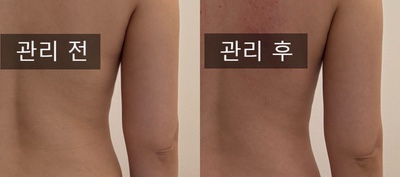  대구 신천동 피부관리실 예림스킨앤바디