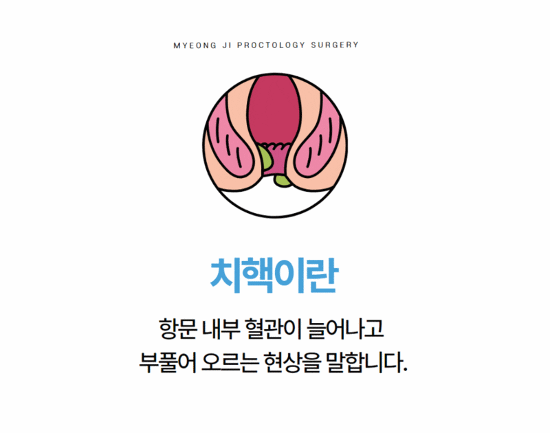 부산치질수술잘하는병원, 대장항문외과 세부전문의가 있는지 확인하세요