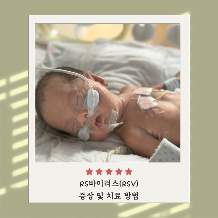 RSV 바이러스 증상 및 치료방법 RS바이러스 백신 시나지스 RSV 바이러스 증상 및 치료방법 RS바이러스 백신 시나지스