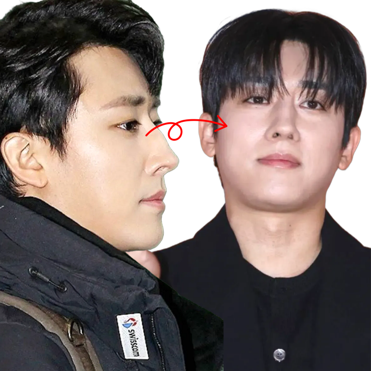  손호준 최근 코성형 수술? 달라진 얼굴 분위기
