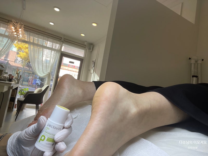 포항 효자동 네일샵 비올라푸스케어에서 티눈 제거