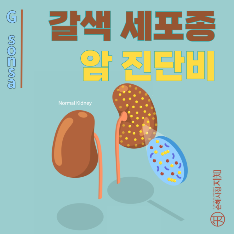  갈색세포종(크롬친화세포종), 양성종양(D35)이라고 들었는데 암보험금 청구할 수 있나요? - 〔아빠의 질병, 2부〕