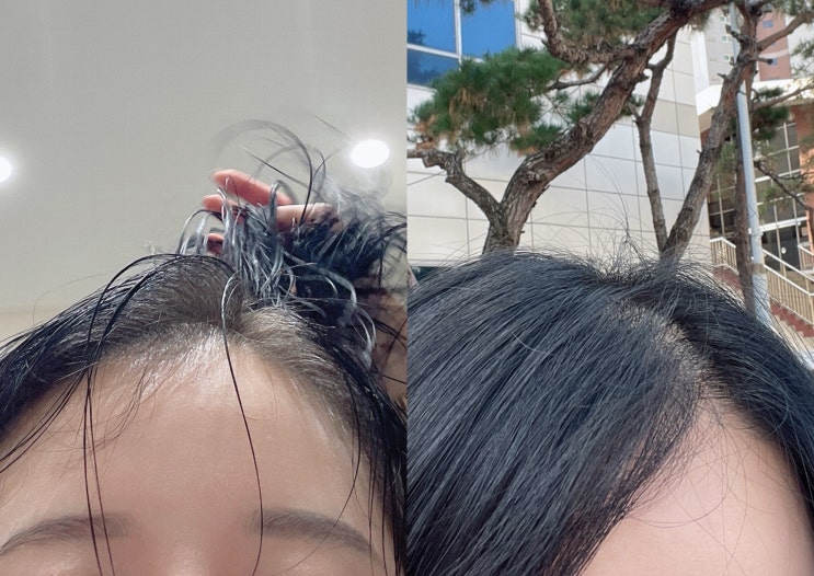  대구 동성로 미용실 톤다운 뿌리염색 전후변화