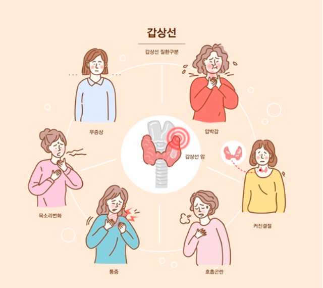  갑상선암 초기 증상 알아보기