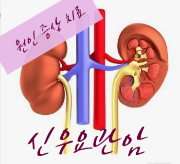 신우요관암 원인과 증상 그리고 생존율 암완치사례후기