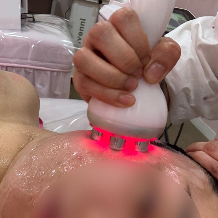  칠곡 석적 피부관리 스킨케어5000 하이푸 울쎄라