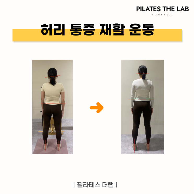  목동 필라테스 허리 통증 재활 운동 후기