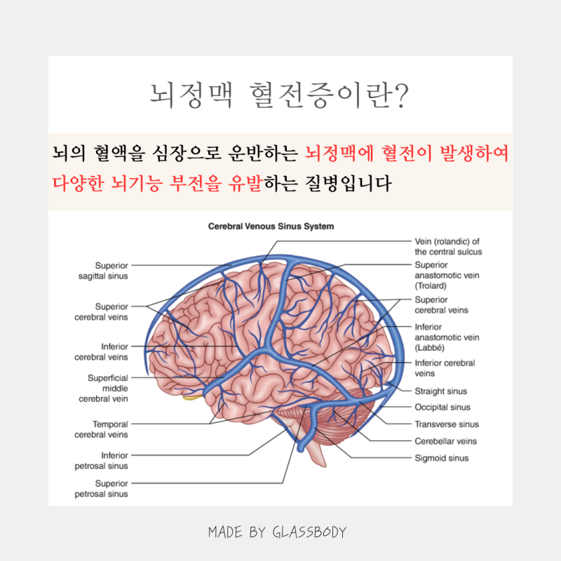 뇌정맥 혈전증의 증상과 치료방법에 대해서 알아보아요
