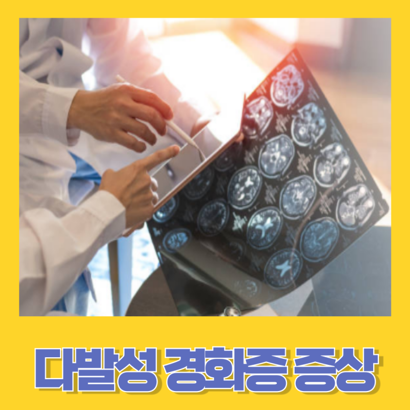 다발성 경화증 원인과 증상 치료법과 관리법