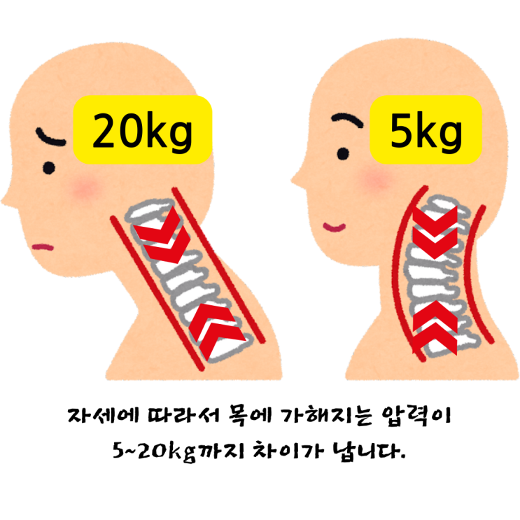  경성대한의원, 목디스크 환자가 알아야 할 비수술 회복의 핵심