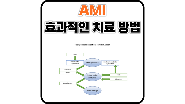  AMI 치료에 효과적인 방법