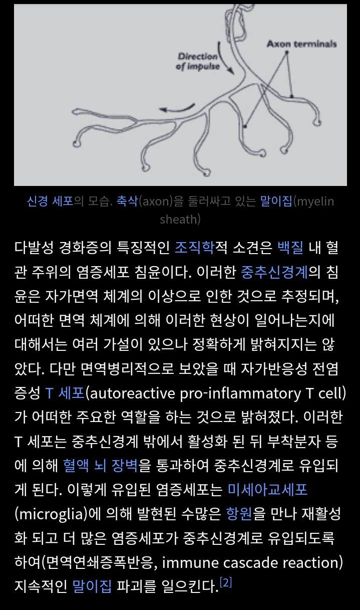 열혈사제 다발성 경화증 열혈사제 다발성 경화증