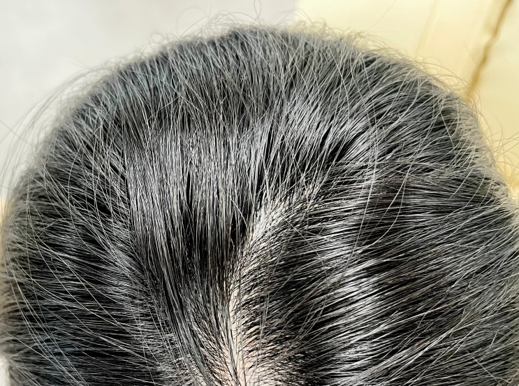 임산부 탈모샴푸 고민하다 정착 성공