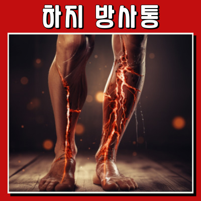 허리나 엉덩이에서 시작하여 다리로 방사되는 통증