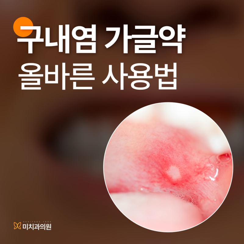 구내염 가글약 헥사메딘 탄툼 사용법