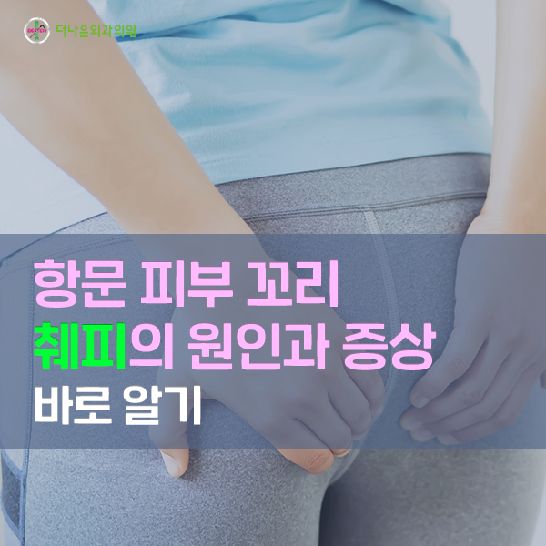 항문피부꼬리 췌피의 원인과 증상 바로 알기