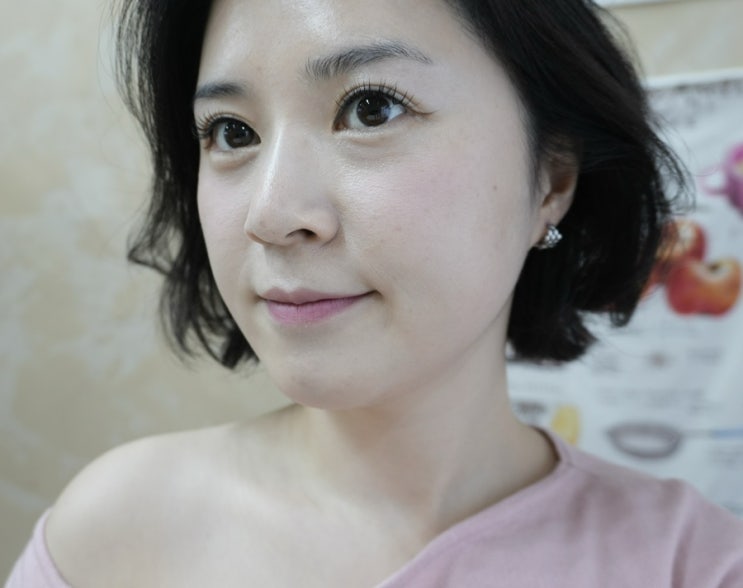  울쎄라 300샷 붓기 2주차 3주차 한달 후기(이중턱리프팅)