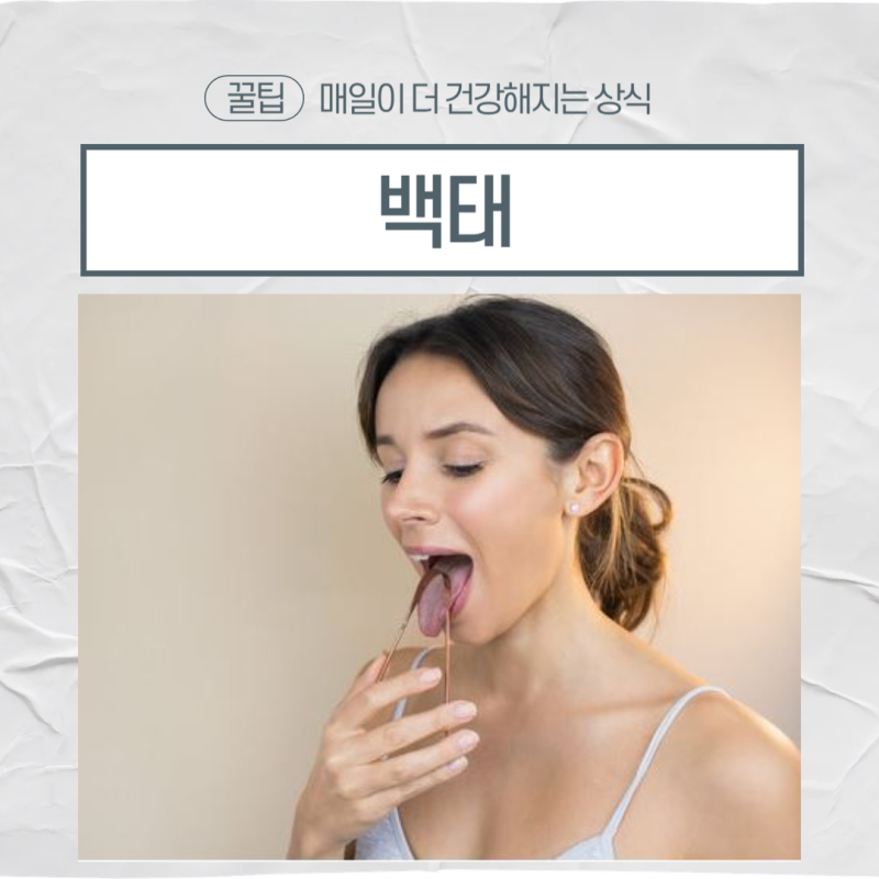 혓바닥 백태 없애는 법, 백태 제거 방법
