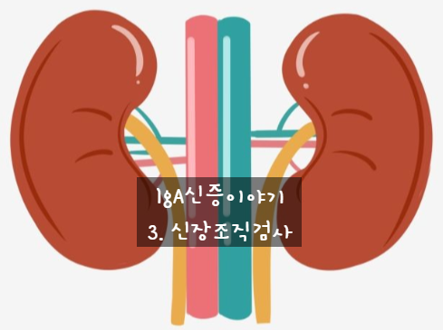 IgA신증이야기-3.신장조직검사(콩팥생검)