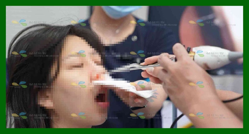 비염 코성형비용 정리하면